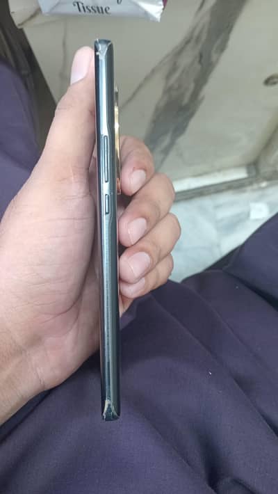 Honor X9B 5 G