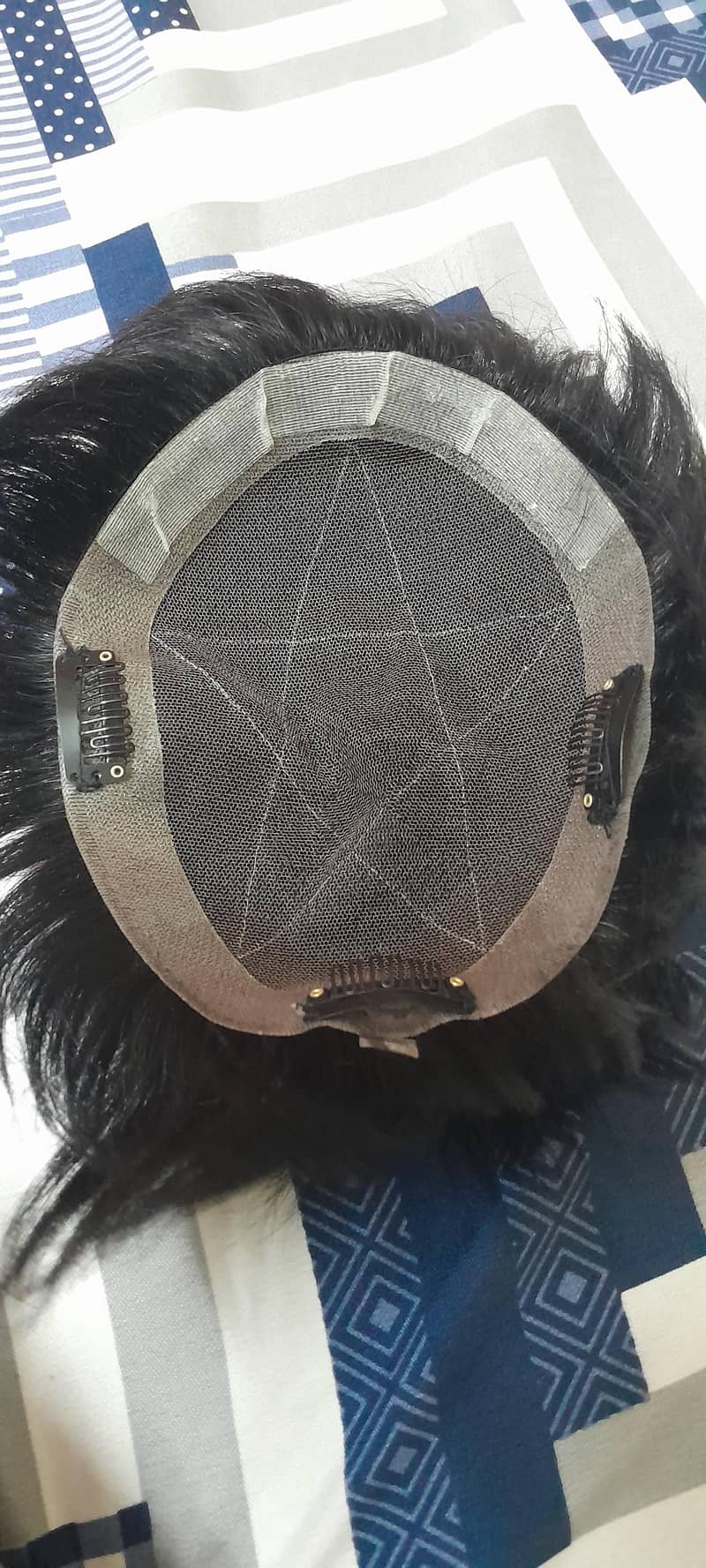 hair patch 1