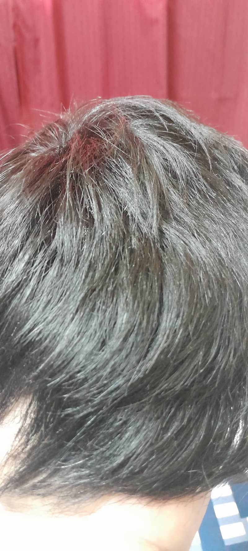 hair patch 3