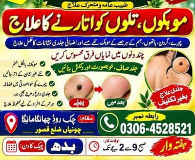 تلوں اور موہکوں کے علاج کے لیے رابطہ کریں