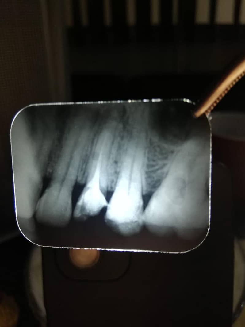 Dental xray machine 0