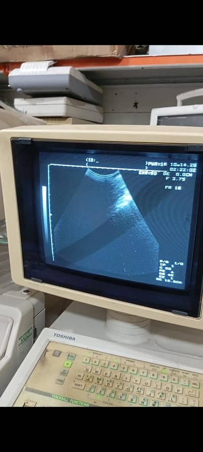 Toshiba ultra sound machine for sale