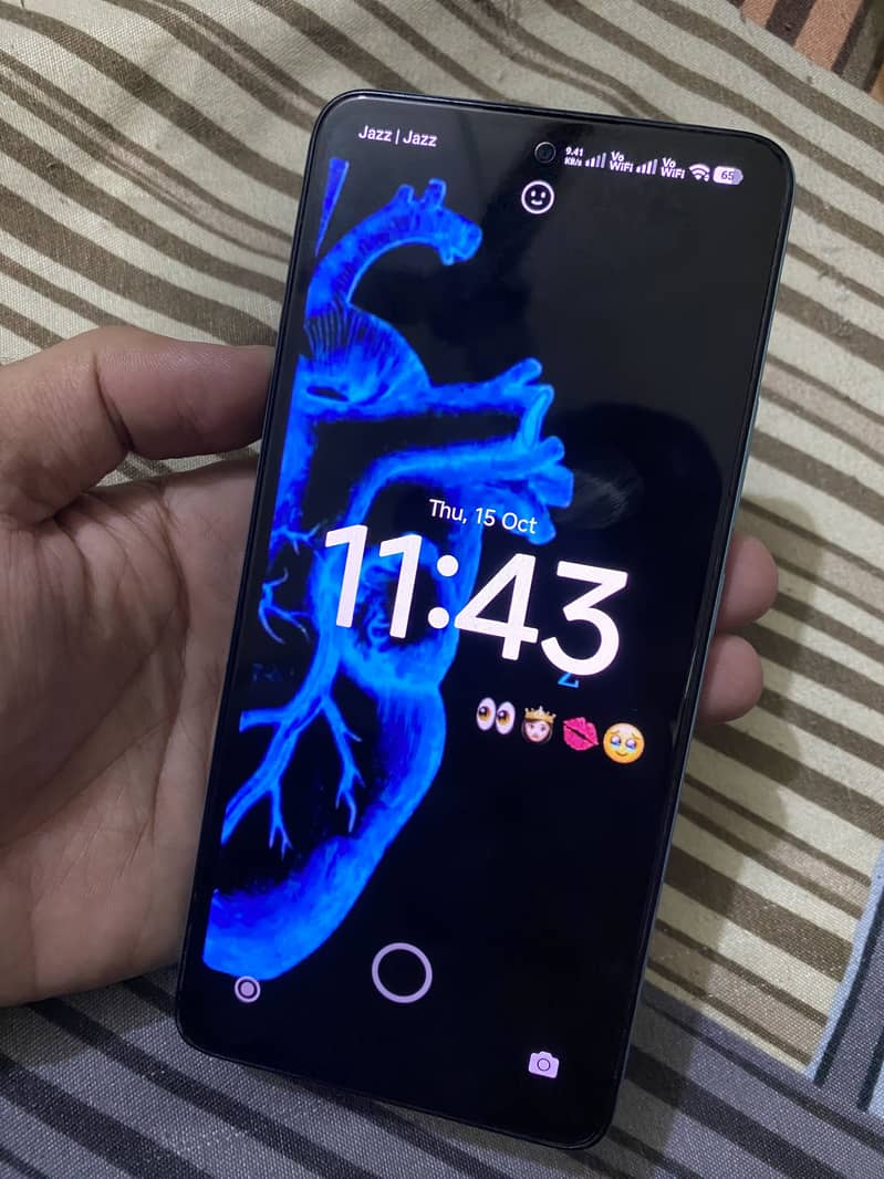 Xiaomi Redmi Note 14 5