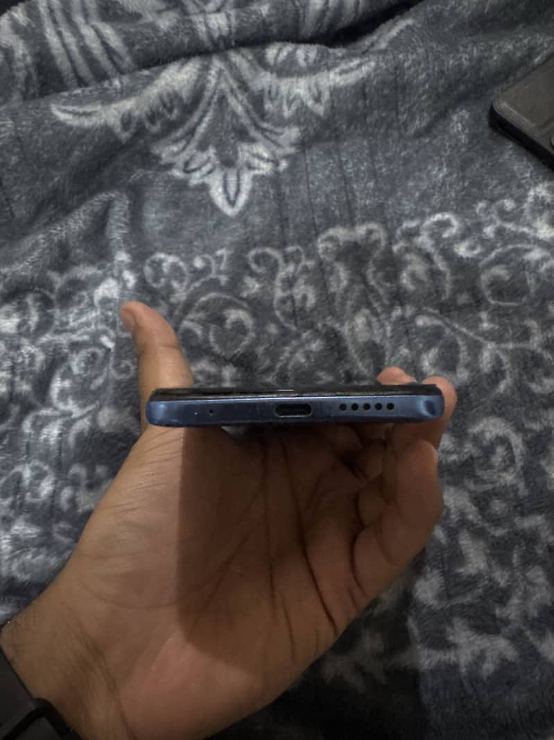 Xiaomi Redmi Note 11 4