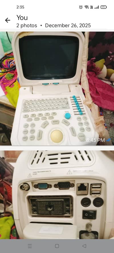 Novadex Ultrasound Machine