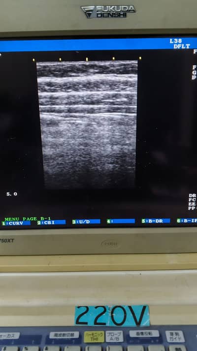 Fukuda 750 Ultrasound dual probe doppler with trolley and invertor