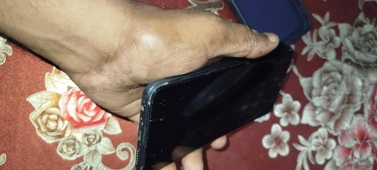 Infinix Note 10 11