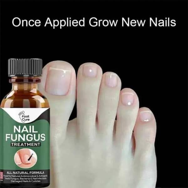 Nail Fungus Treatment Stop Fungal Growth Effective Fingernail 10ml