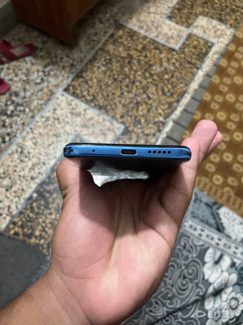 Xiaomi Redmi Note 11 3