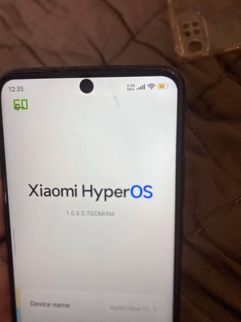 Xiaomi Redmi Note 11 7