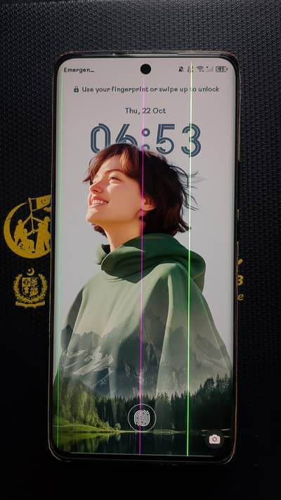 Honor X9b