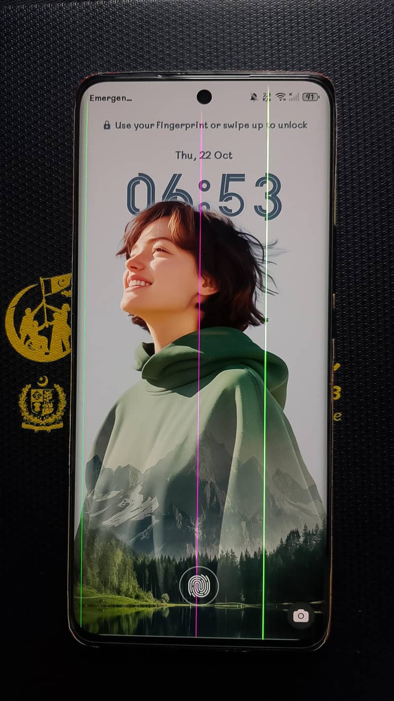 Honor X9b 0