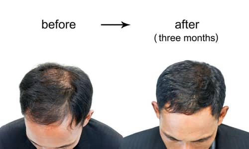 Biotin Gummies 5000mcg - Hair Growth Vitamins