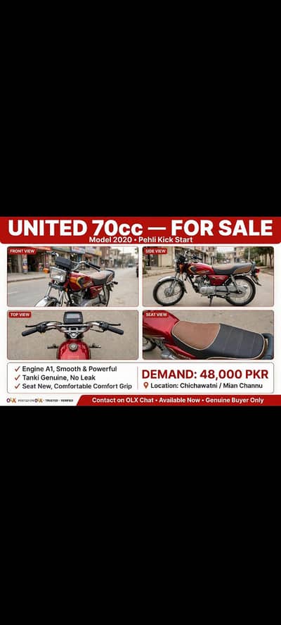 united 20 model