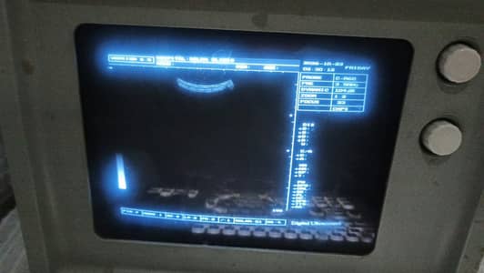 ultrasound machine