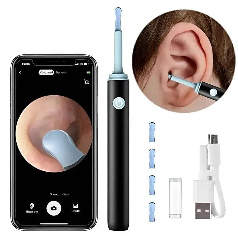 Smart Visual Ear wax cleaning 4