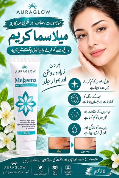 Melasma cream