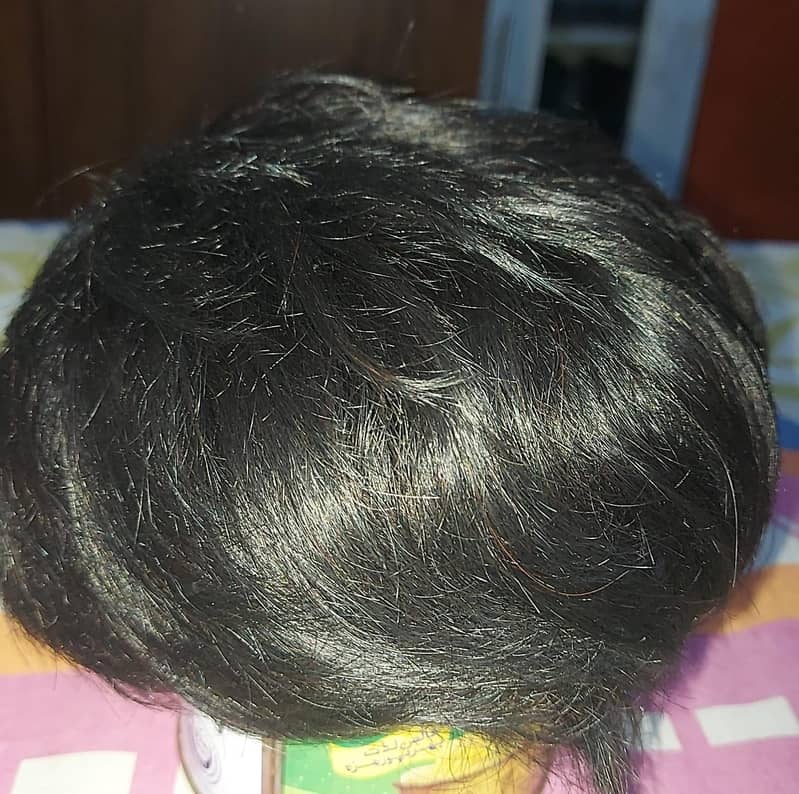 Hair Patch Universal 1