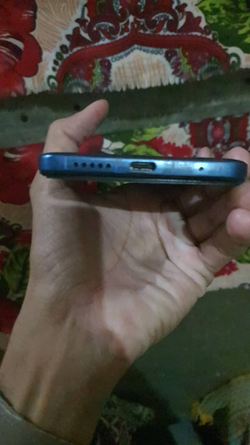 Redmi note11 3