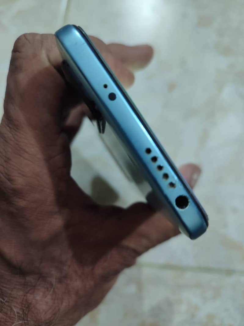 Xiaomi Redmi Note 11 3
