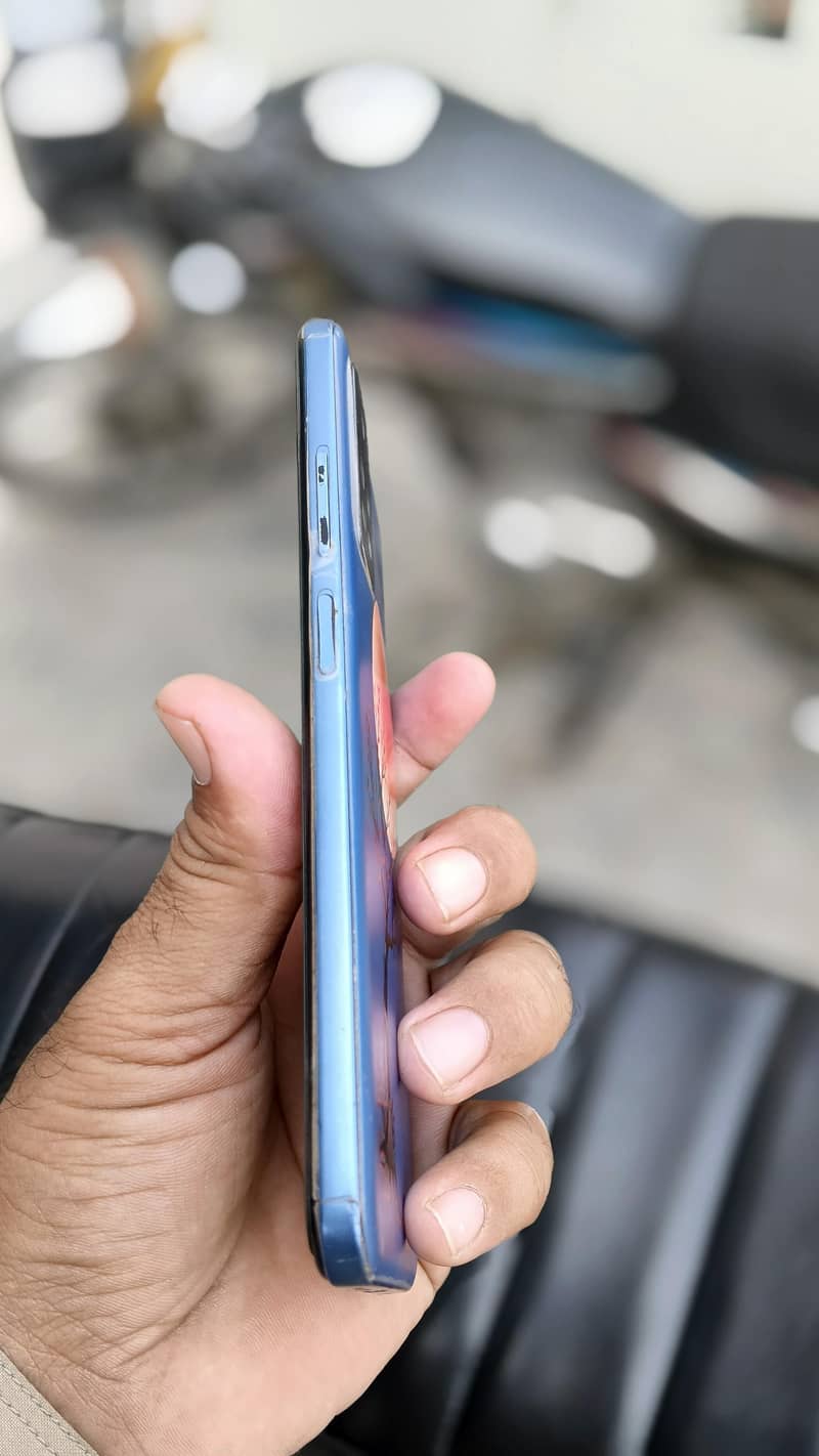 Xiaomi Redmi Note 11 3