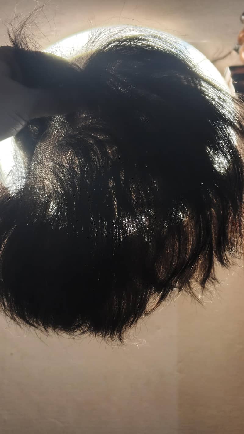 korein Hair patch 0