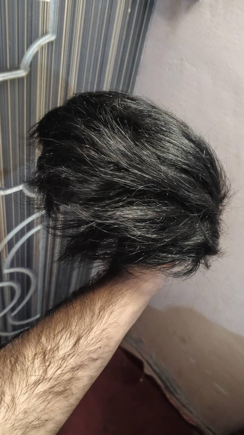 korein Hair patch 1