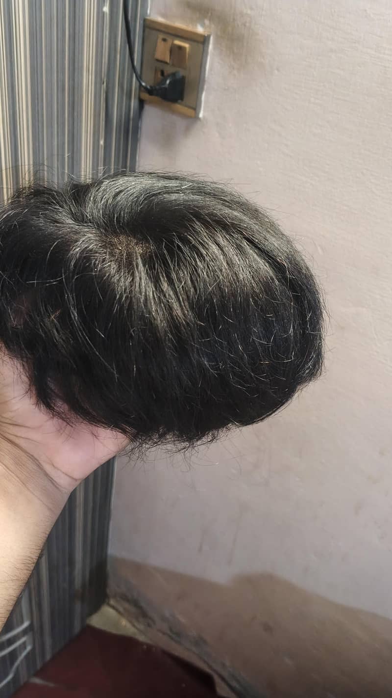 korein Hair patch 2