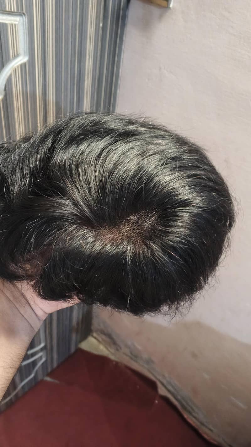 korein Hair patch 3