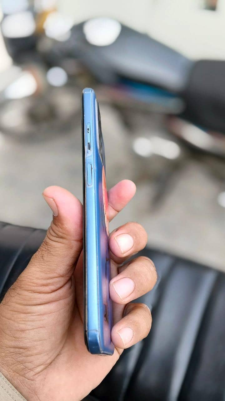 Xiaomi Redmi Note 11 1
