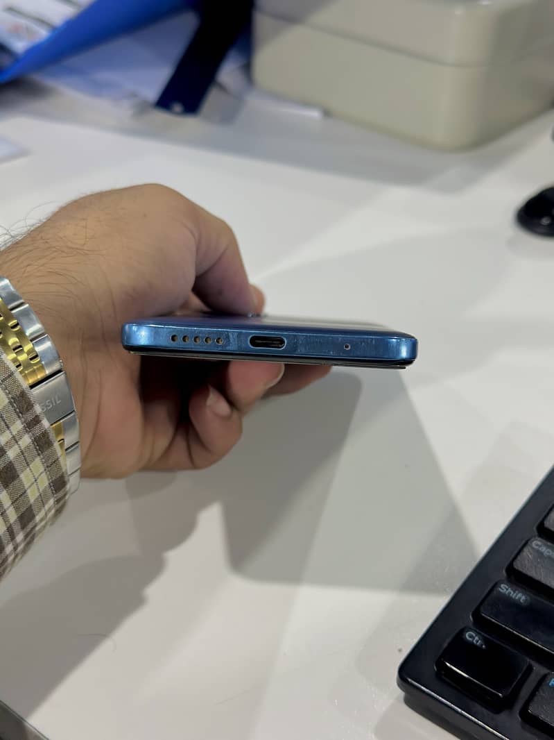 Xiaomi Redmi Note 11 6