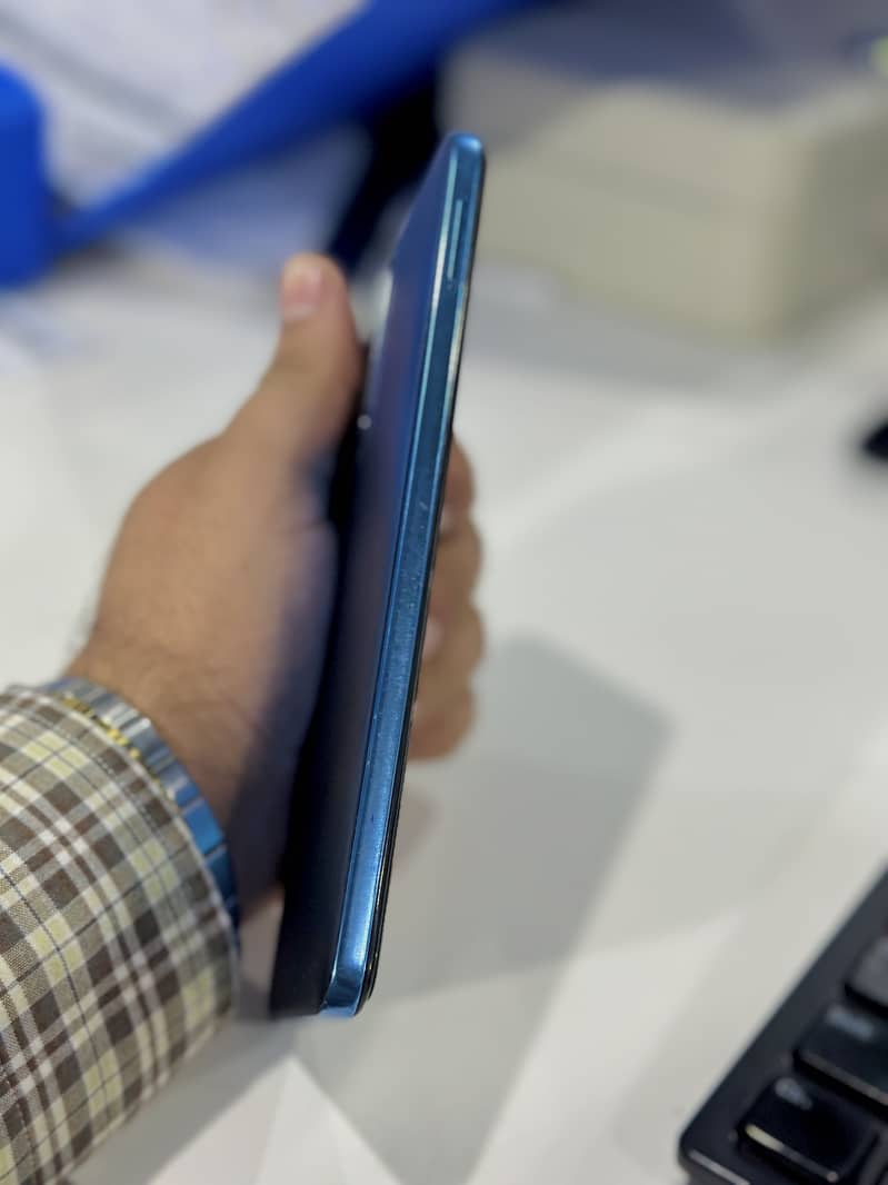 Xiaomi Redmi Note 11 7