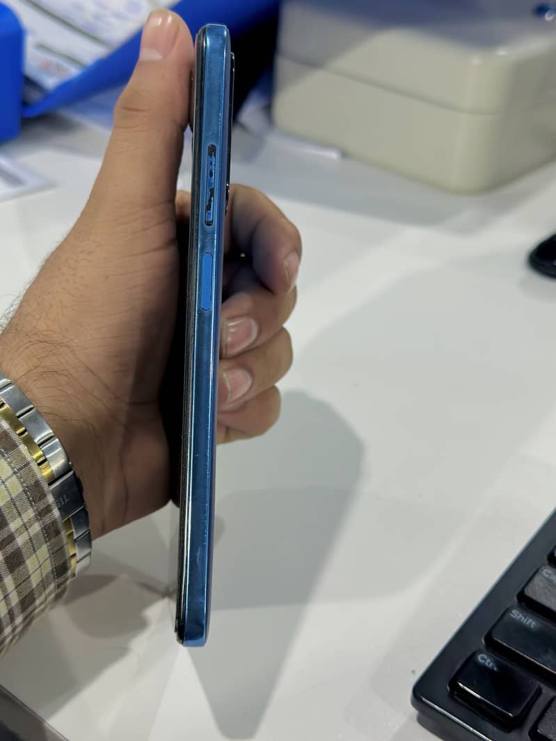 Xiaomi Redmi Note 11 8