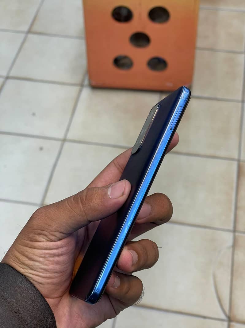 Xiaomi Redmi Note 11 3