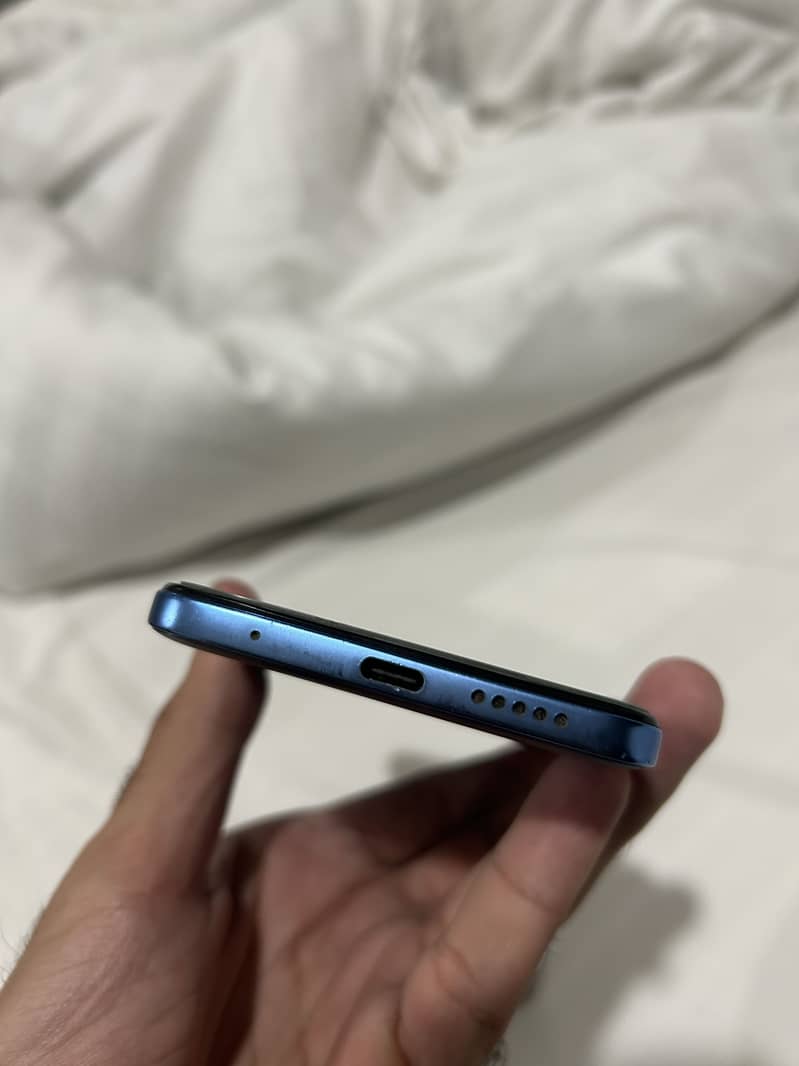 Xiaomi Redmi Note 11 6