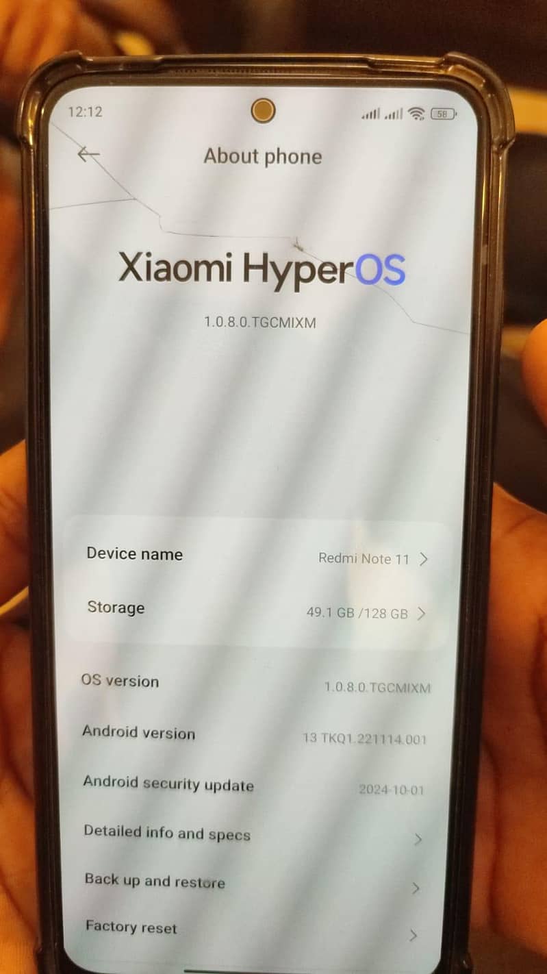 Xiaomi Redmi Note 11 4