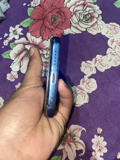 Xiaomi Redmi Note 11
