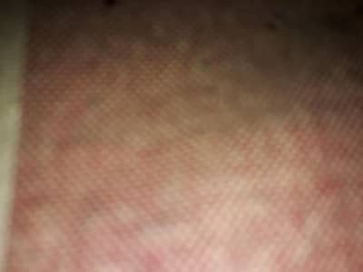 haer medium size front red or side gray coler hai