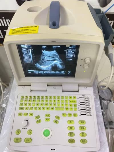 Zone Ultrasound Machine Chinese Assemble Machine